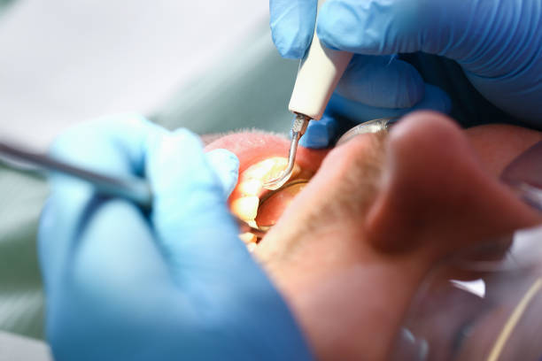 Best Broken or Cracked Tooth Emergency Dentist in Affton, MO
